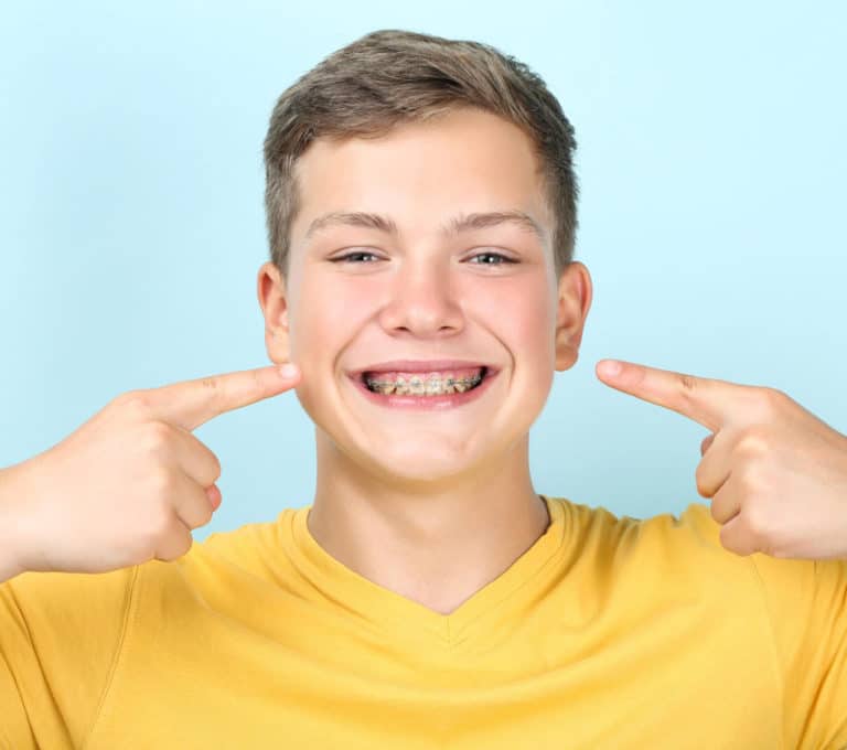 Smiling boy with braces pointing at his teeth