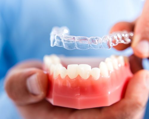 Invisible and removable aligners for teeth alignment Close-up. The doctor puts transparent aligners on the teeth of the artificial jaw
